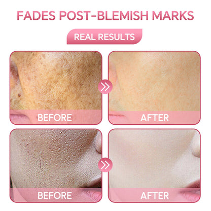 Treatments and results of Vitamin B3 niacinamide serum