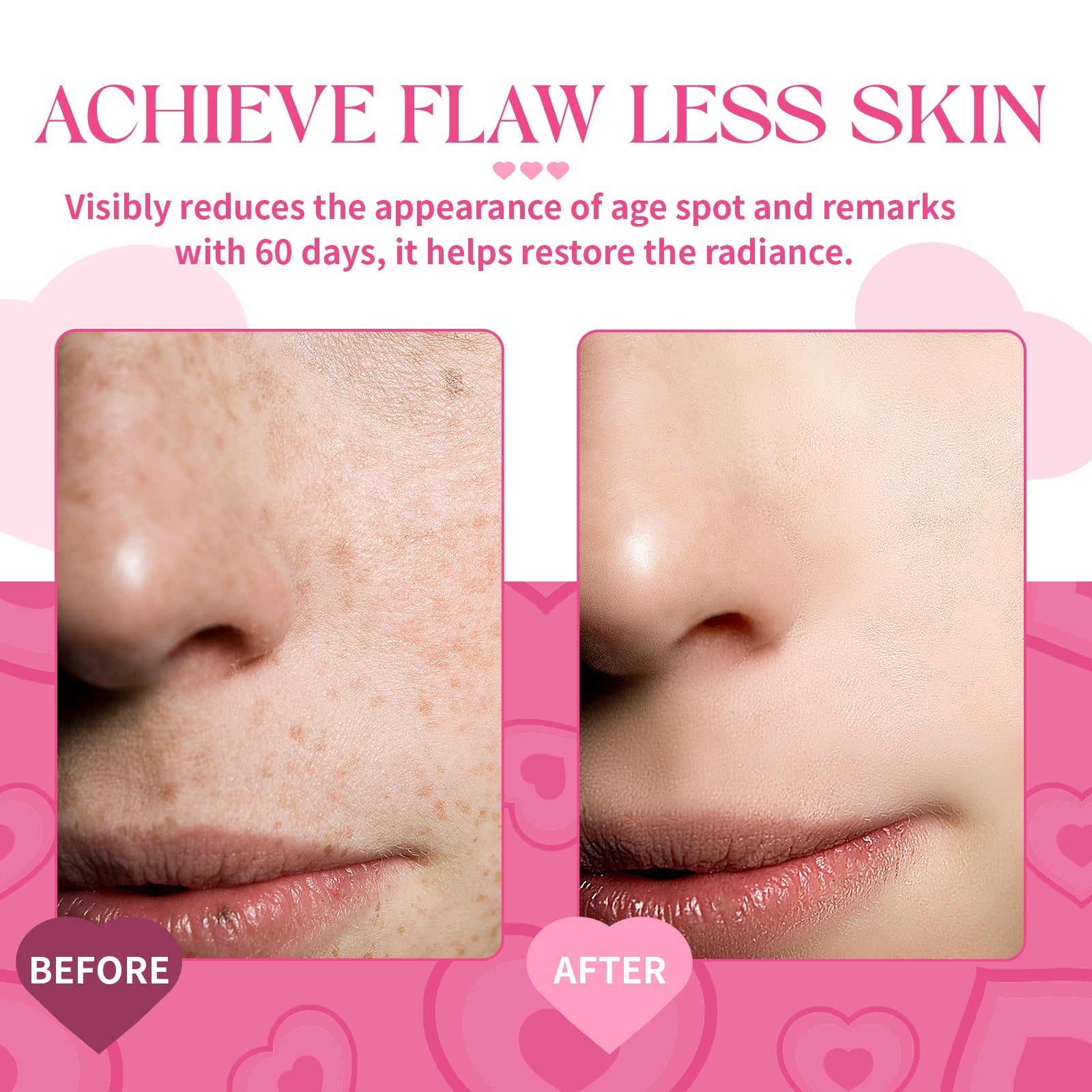 turmeric kojic acid cleansing pads reduce age spots