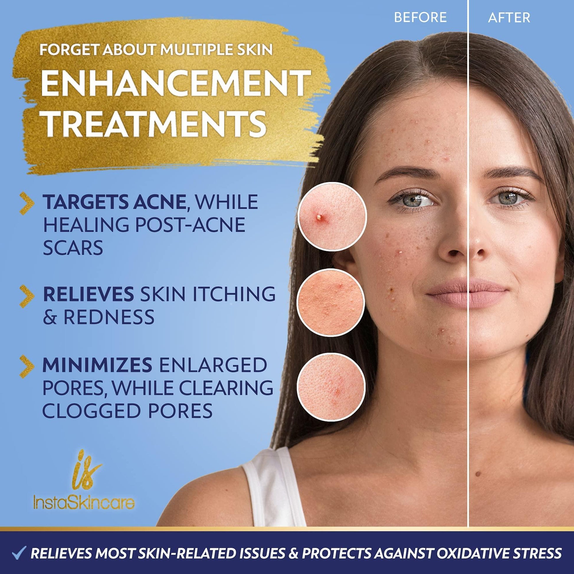 brightening facial serum against acne and pores